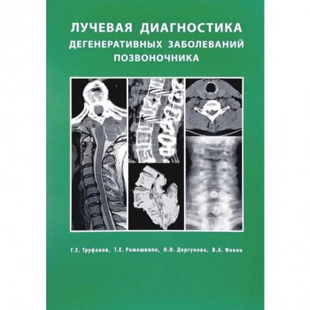 Другие виды специальной медицины, книга Лучевая диагностика  дегенеративных заболеваний позвоночника купить по низкой цене