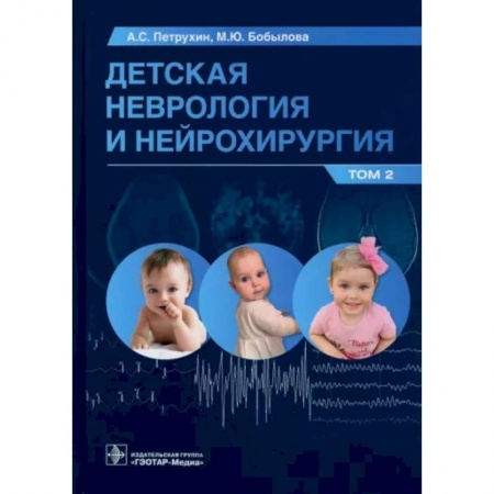 Неврология, книга Детская неврология и нейрохирургия. Том 2 купить по низкой цене