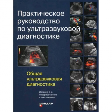 УЗИ. ЭКГ. Томография. Рентген, книга Практическое руководство по ультразвуковой диагностике. Общая ультразвуковая диагностика купить по низкой цене
