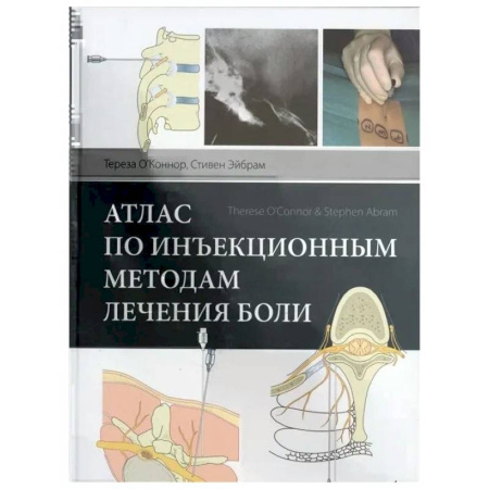 Онкология, книга Атлас по инъекционным методам лечения боли купить по низкой цене