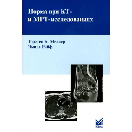 Другие виды специальной медицины, книга Норма при КТ- и МРТ-исследованиях купить по низкой цене