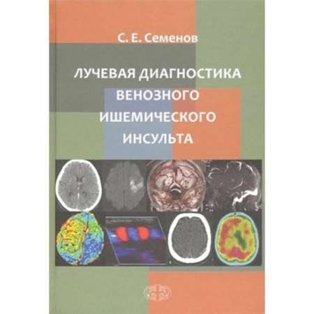 Кардиология, книга Лучевая диагностика венозного ишемического инсульта купить по низкой цене