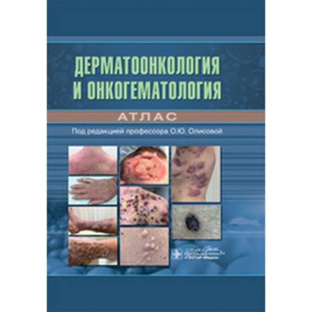 Кожные и венерические болезни, книга Дерматоонкология и онкогематология купить по низкой цене