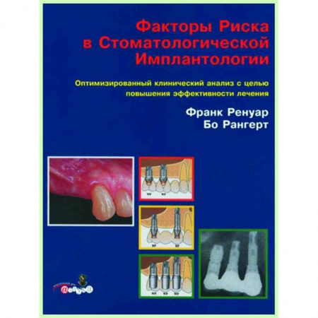 Стоматология, книга Факторы риска в стоматологической имплантологии. купить по низкой цене