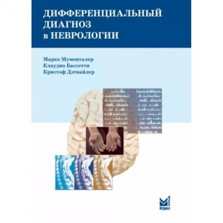 Неврология, книга Дифференциальный диагноз в неврологии. Руководство по оценке, классификации и дифференциональной диагностике неврологических симптомов купить по низкой цене
