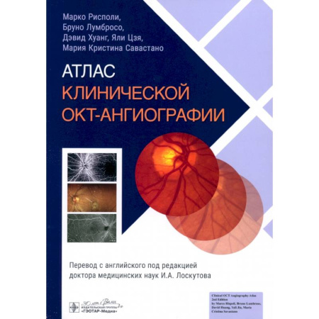 ЛОР. Оториноларингология, книга Атлас клинической ОКТ-ангиографии купить по низкой цене