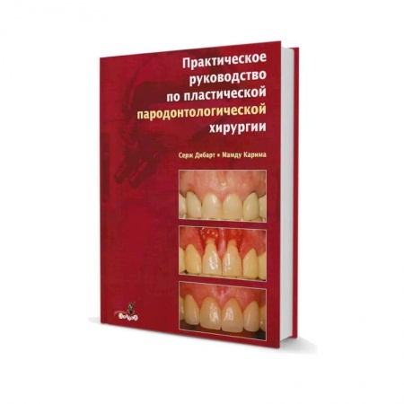 Стоматология, книга Практическое руководство по пластической парадонтологической хирургии купить по низкой цене