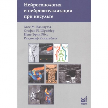 Специальная медицина, книга Нейросонология и нейровизуализация при инсульте купить по низкой цене