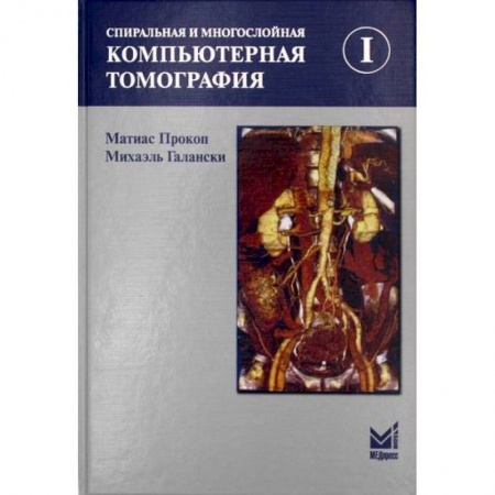 УЗИ. ЭКГ. Томография. Рентген, книга Спиральная и многослойная компьютерная томография купить по низкой цене