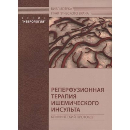 Кардиология, книга Реперфузионная терапия ишемического инсульта. Клинический протокол купить по низкой цене
