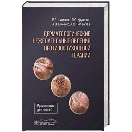 Другие терапии, книга Дерматологические явления противоопухолевой терапии купить по низкой цене