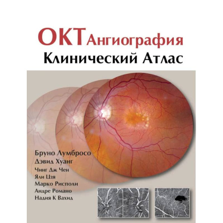 ЛОР. Оториноларингология, книга ОКТ-ангиография. Клинический атлас купить по низкой цене