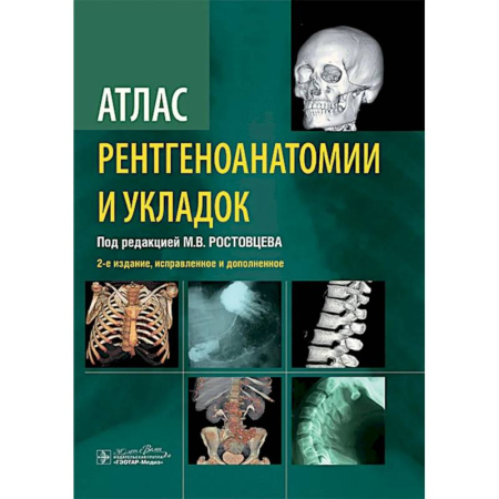 УЗИ. ЭКГ. Томография. Рентген, книга Атлас рентгеноанатомии и укладок: руководство для врачей купить по низкой цене