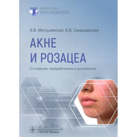 Кожные и венерические болезни, книга Акне и розацеа купить по низкой цене