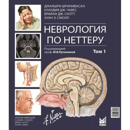 Медицинские энциклопедии и справочники, книга Неврология по Неттеру. В 3 т. Т. 1 купить по низкой цене