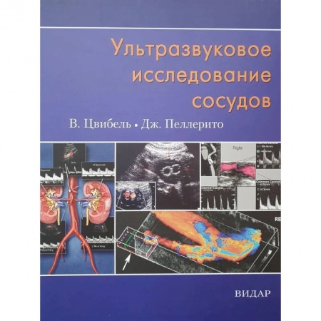 УЗИ. ЭКГ. Томография. Рентген, книга Ультразвуковое исследование сосудов купить по низкой цене
