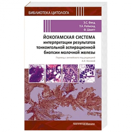 Медицинские энциклопедии и справочники, книга Йокогамская система интерпретации результатов тонкоигольной аспирационной биопсии молочной железы купить по низкой цене