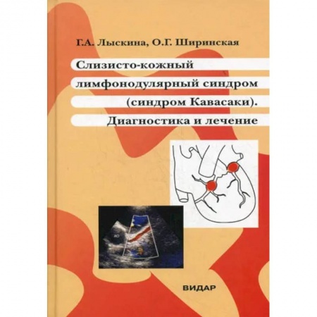 Кожные и венерические болезни, книга Слизисто-кожный лимфонодулярный синдром (синдром Кавасаки). Диагностика и лечение купить по низкой цене