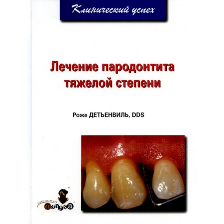 Стоматология, книга Лечение пародонтита тяжелой степени купить по низкой цене