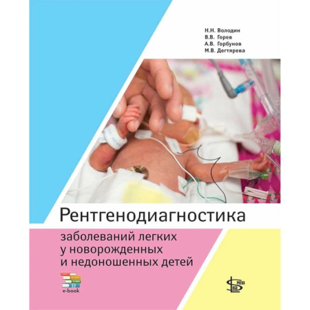 УЗИ. ЭКГ. Томография. Рентген, книга Рентгенодиагностика заболеваний легких у новорожденных и недоношенных детей: Учебное пособие купить по низкой цене