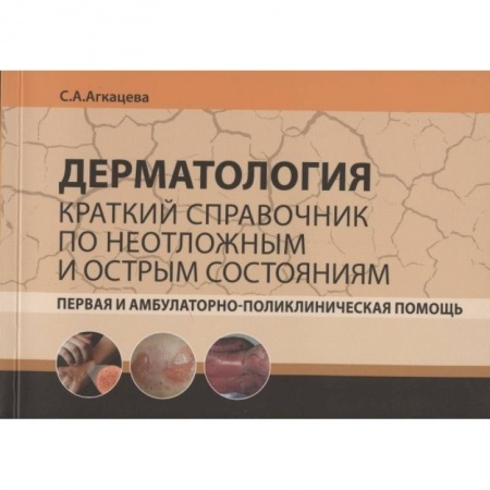Медицинские энциклопедии и справочники, книга Дерматология. Краткий справочник по неотложным и острым состояниям купить по низкой цене