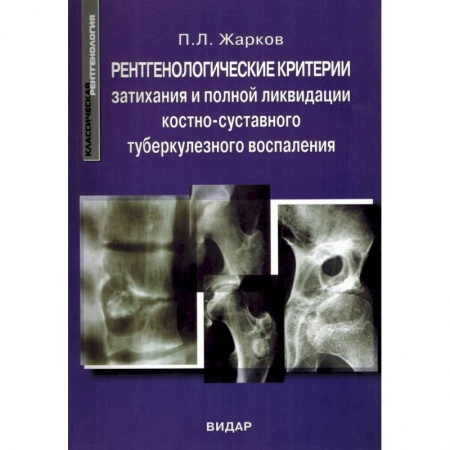 УЗИ. ЭКГ. Томография. Рентген, книга Рентгенологические критерии затихания и полной ликвидации костно-суставного туберкулезного воспаления купить по низкой цене