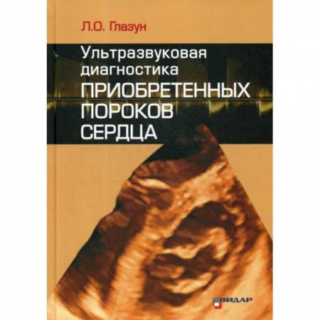 УЗИ. ЭКГ. Томография. Рентген, книга Ультразвуковая диагностика приобретенных пороков сердца купить по низкой цене