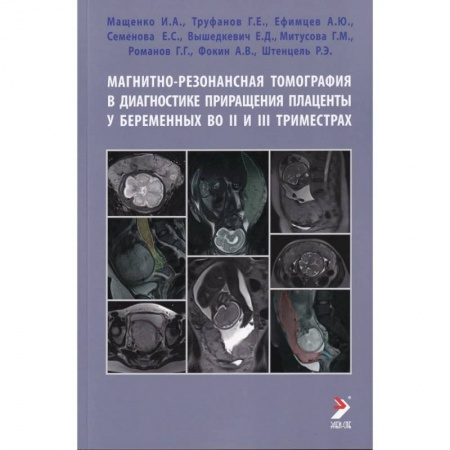 УЗИ. ЭКГ. Томография. Рентген, книга Магнитно-резонансная томография в диагностике приращения плаценты у беременных во II и III триместрах купить по низкой цене
