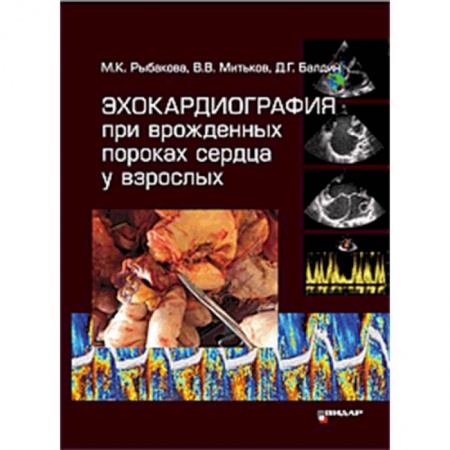 Кардиология, книга Эхокардиография при врожденных пороках сердца у взрослых купить по низкой цене
