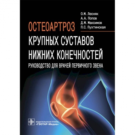 Книги, книга Остеоартроз крупных суставов нижних конечностей купить по низкой цене