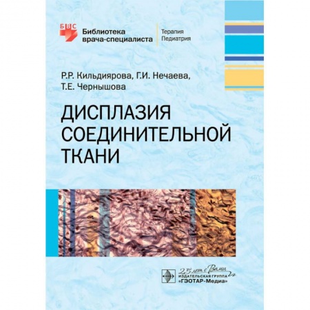 Медицина. Фармакология, книга Дисплазия соединительной ткани купить по низкой цене