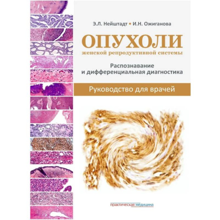 Здоровье, медицинская литература, книга Опухоли женской репродуктивной системы. Распознавание и дифференциальная диагностика. Руководство для врачей купить по низкой цене