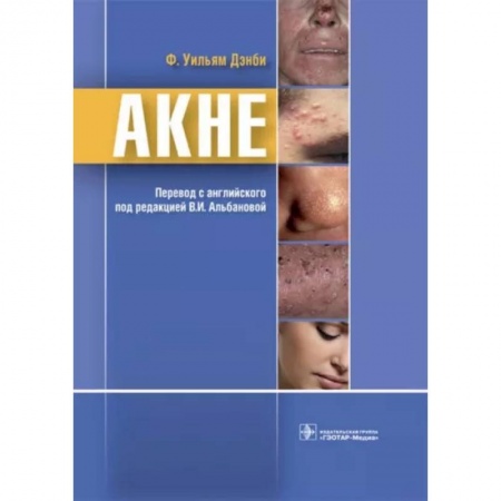 Кожные и венерические болезни, книга Акне купить по низкой цене