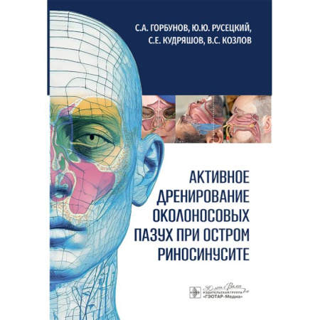Медицинские энциклопедии и справочники, книга Активное дренирование околоносовых пазух при остром риносинусите купить по низкой цене
