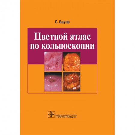 Акушерство и гинекология, книга Цветной атлас по кольпоскопии купить по низкой цене