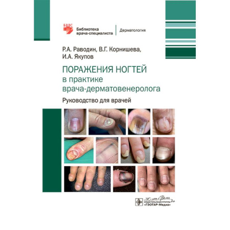 Медицинские энциклопедии и справочники, книга Поражения ногтей в практике врача-дерматовенеролога: руководство для врачей купить по низкой цене