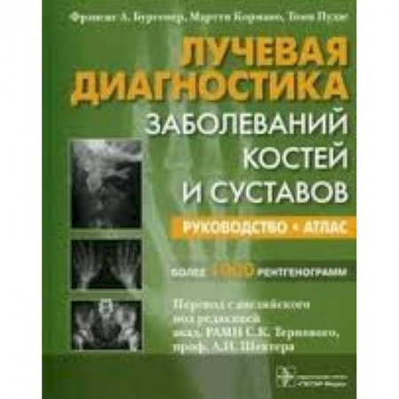 Диагностика. Методы и виды, книга Лучевая диагностика заболеваний костей и суставов купить по низкой цене
