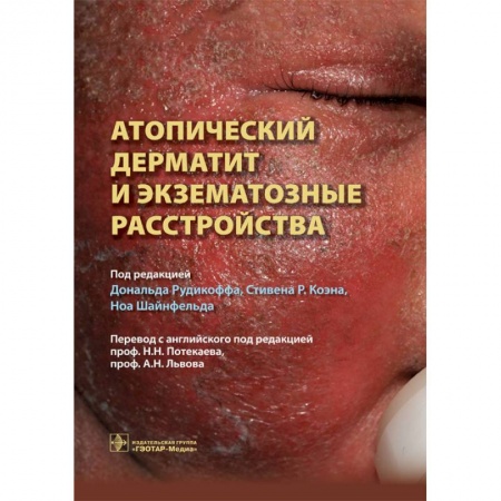 Книги, книга Атопический дерматит и экзематозные расстройства купить по низкой цене
