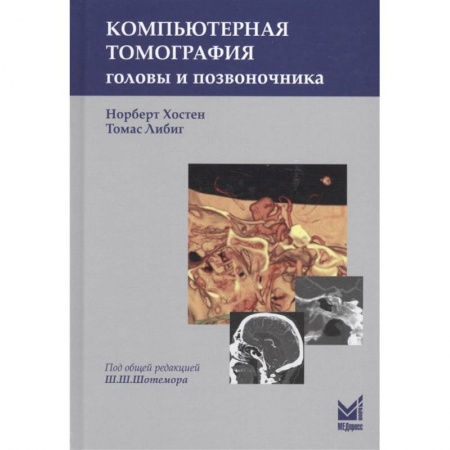 Специальная медицина, книга Компьютерная томография головы и позвоночника купить по низкой цене