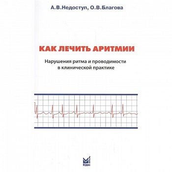 Как лечить аритмии. Нарушение ритма и проводимости в клинической практике