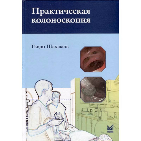 Медицинские энциклопедии и справочники, книга Практическая колоноскопия. Методика, рекомендации, советы и приемы купить по низкой цене