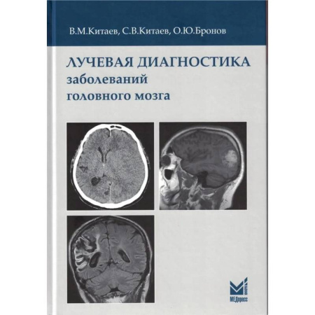 Другие виды специальной медицины, книга Лучевая диагностика заболеваний головного мозга купить по низкой цене