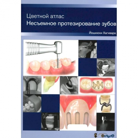 Стоматология, книга Несъемное протезирование зубов. Цветной атлас купить по низкой цене