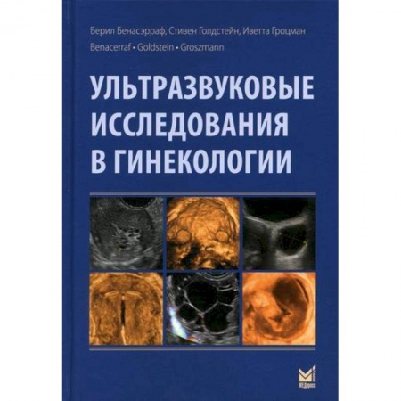 Акушерство и гинекология, книга Ультразвуковые исследования в гинекологии купить по низкой цене