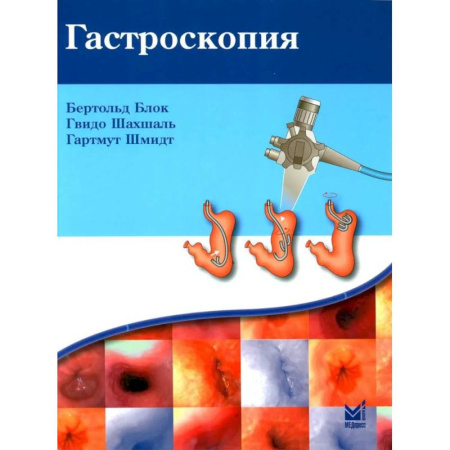 Гастроэнтерология, книга Гастроскопия купить по низкой цене