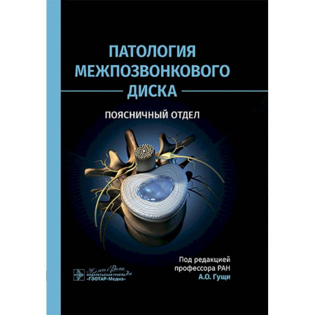 Здоровье, медицинская литература, книга Патология межпозвонкового диска. Поясничный отдел купить по низкой цене