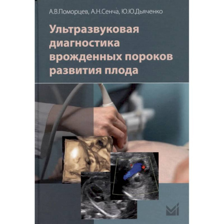 Диагностика. Методы и виды, книга Ультразвуковая диагностика врожденных пороков развития плода купить по низкой цене
