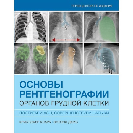 Другие виды специальной медицины, книга Основы рентгенографии органов грудной клетки купить по низкой цене