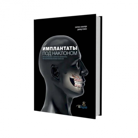 Стоматология, книга Имплантаты под наклоном. Протезирование с опорой на имплантаты при выраженной атрофии челюстей купить по низкой цене