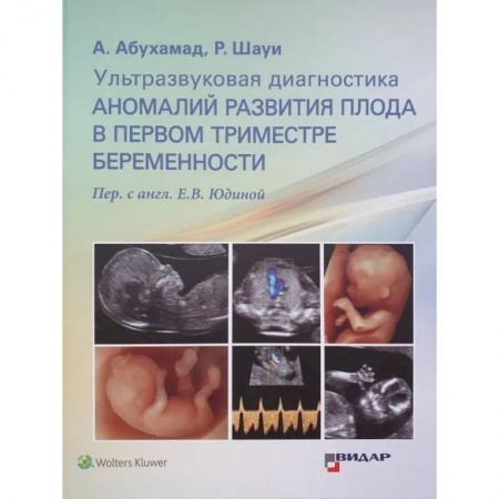 УЗИ. ЭКГ. Томография. Рентген, книга Ультразвуковая диагностика аномалий развития плода в первом триместре беременности купить по низкой цене
